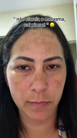 Chega de pele manchada! #clareadordemanchas #melasma #clareador 