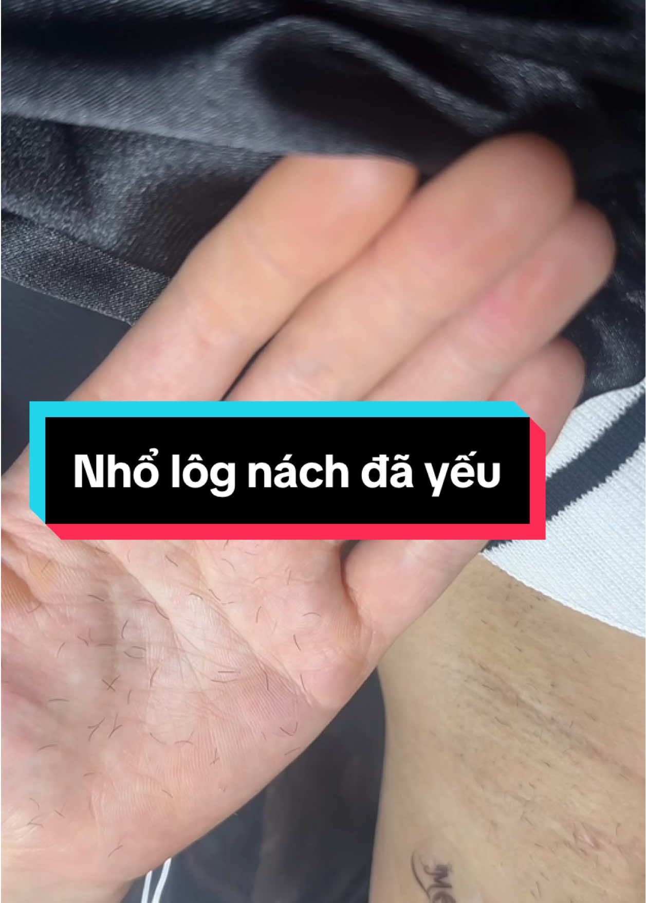 Máy Diode xịn an toàn Chiếu tia nhẹ dịu, lông rụng nhẹ nhàng #trietlong #trietlongvinhvien #chamsocda #spa #trietlongnach