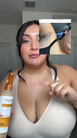 Replying to @Mariyah LPN 🥰 don’t know how I feel about him having these 😭😭 but my skin is glowinggggg #skincare #drmelaxinpeelshotbodyandface #drmelaxinpeelshot #glowingskin #skinexfoliating @drmelaxinglow 