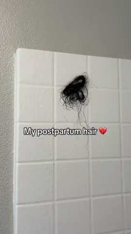 Good news is I’ll match my husband AND my baby soon #postpartum #postpartumhairloss #postpartumhair 