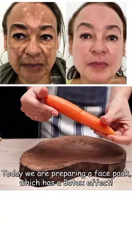 Banana peel Erases all wrinkles on your face_ You will look younger with the banana peel_ #skinwrinkles #skincareroutine #wrinkles #skincare #wrinklesremove 