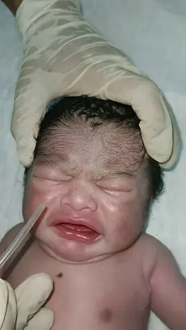 newborn baby after birth saction process #newborn #baby #nicu #nursing #hospitalnicu0 