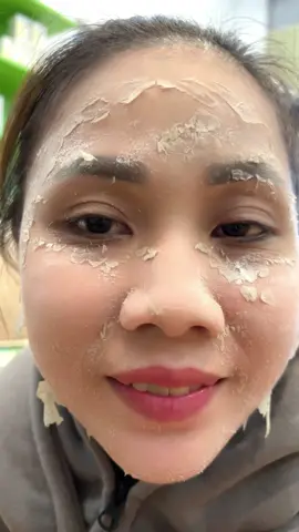 Đánh bay nám , tàn nhang#xuhuong #xuhuongtiktok #peelda #yodyphuonganh #làm_đẹp_mỗi_ngày #chuyênđiềutrịnámmụntànnhangsẹo 