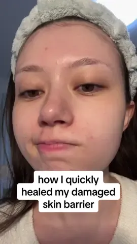 how I healed my damaged skin barrier 🤍 this is a super simple routine, but sometimes thats what you need!  -@ヒロインメイク/heroinemake speedy mascara remover -@SKIN1004 US centella light cleansing oil -@HEMEKO / Hesul rice protein gel cleanser (gifted) -@numbuzin re-leaf toner pad + pantothenic b5 serum -@aestura_us atobarrier 365 cream #fyp #skincareroutine #kbeauty #스킨케어 #skinbarrier 