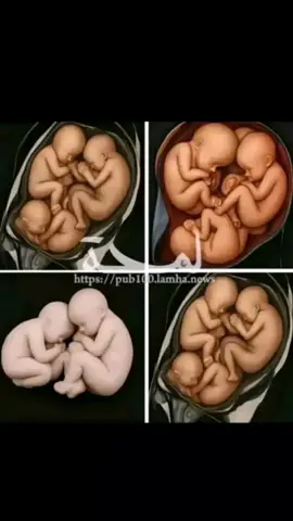 ce miracle se produira bientôt dans ton couple 🤲👩🏼‍🍼🥂🙏 taper AMEN 🙏🏼🌹 Contacter moi pour commande votre kits de fertilité pour finir avec problème l'infériorité n'oublie pas abonné ma page pour votre besoin n'hésitez pas à me contacter sur WhatsApp mon numéro est dans le bio #tiktokbelgium🇧🇪 #tiktokrdcongo🇨🇩 #tiktokfrance🇨🇵 #tiktokviral #usa🇺🇸 