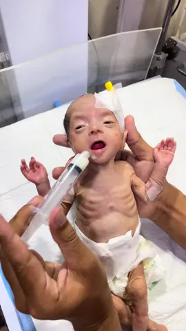👶 Cute Baby in NICU Adorable little movements from our tiny fighter in the NICU. 💖🙏 #CuteBaby #NICUMoments #LittleFighter #BabyLove #adorablebaby 