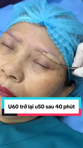 Dịch vụ nâng cung mày giấu chỉ cho cô khách hàng tại Hà Nội #nangcung #nangcungchanmayrutchi #nangcungmay #nangcungchanmay #ilovetiktok 