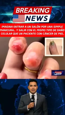 La manicura de gel que podría darte cáncer de piel😱 #ultimahora #news #unitedstates #viralnews #breakingnews 