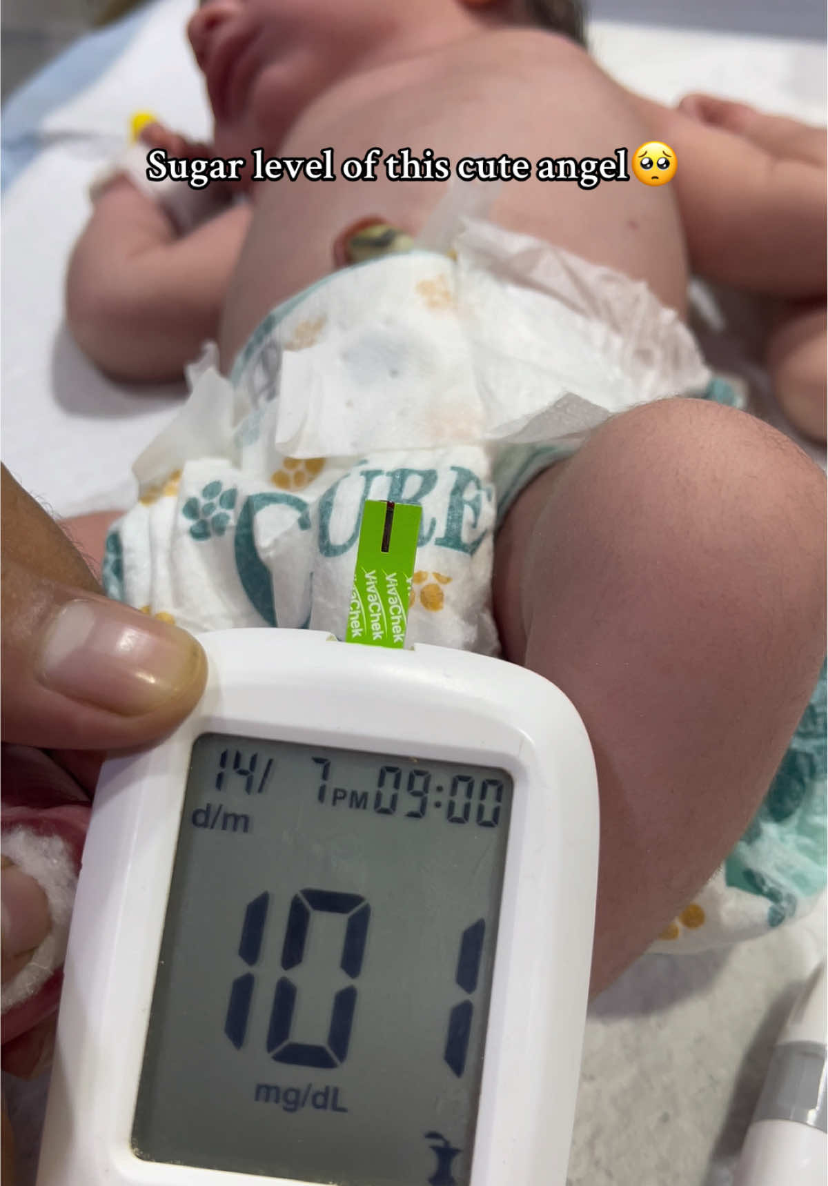 Checking sugar/RBS level of this little cute baby🥺💔 #nicuneonates #nicubaby #nicudoctor 