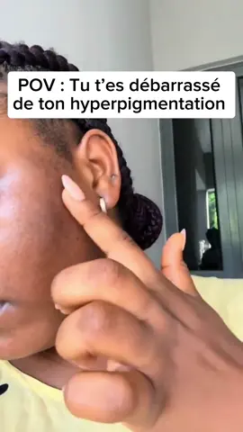 ✨Dites adieu aux taches, à l'hyperpigmentation et au teint terne ! ✨ Découvrez notre savon naturel au curcuma & kojic - un combo puissant pour une peau éclatante, uniforme et sans imperfections. 💛🌿 ✅100% naturel & fait avec amour  ✅Élimine les taches & l'hyperpigmentation ✅Illumine et unifie le teint ✅Convient à tous les types de peau 🔥Résultats visibles dès les premières utilisations! 🔥 Taguez une amie qui a besoin de ce glow naturel👇#fyp #videoviral #turmerickojicsoap 