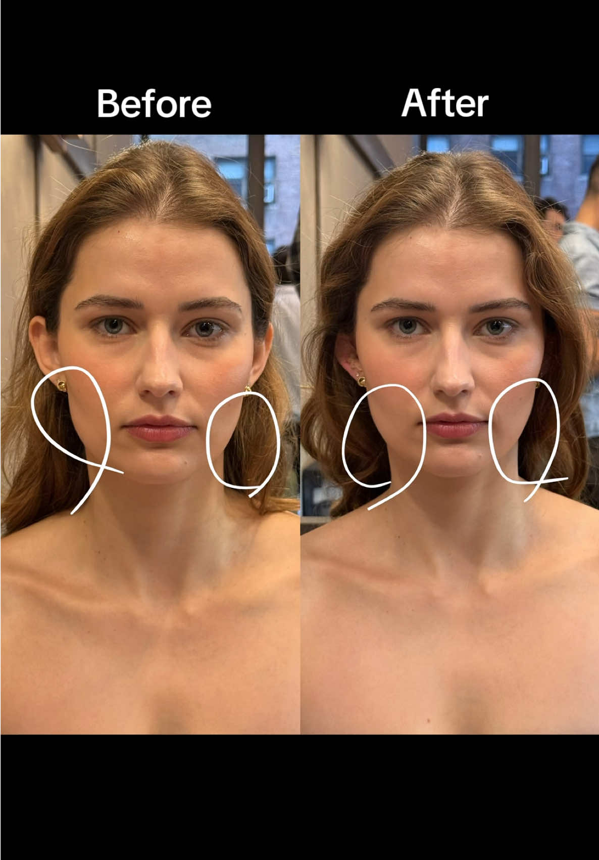 Replying to @leoniebur3 here’s a bit more of a run down on everything ear seeding that @AVA showed me and a better before and after of my face. Based in traditional Chinese medicine but also popular in Korea it helps with inflammation and tension in the body by targeting acupressure points in the ear. These are from @byAVA #earseeds #koreanbeautytips #depuffwithme #acupressure 