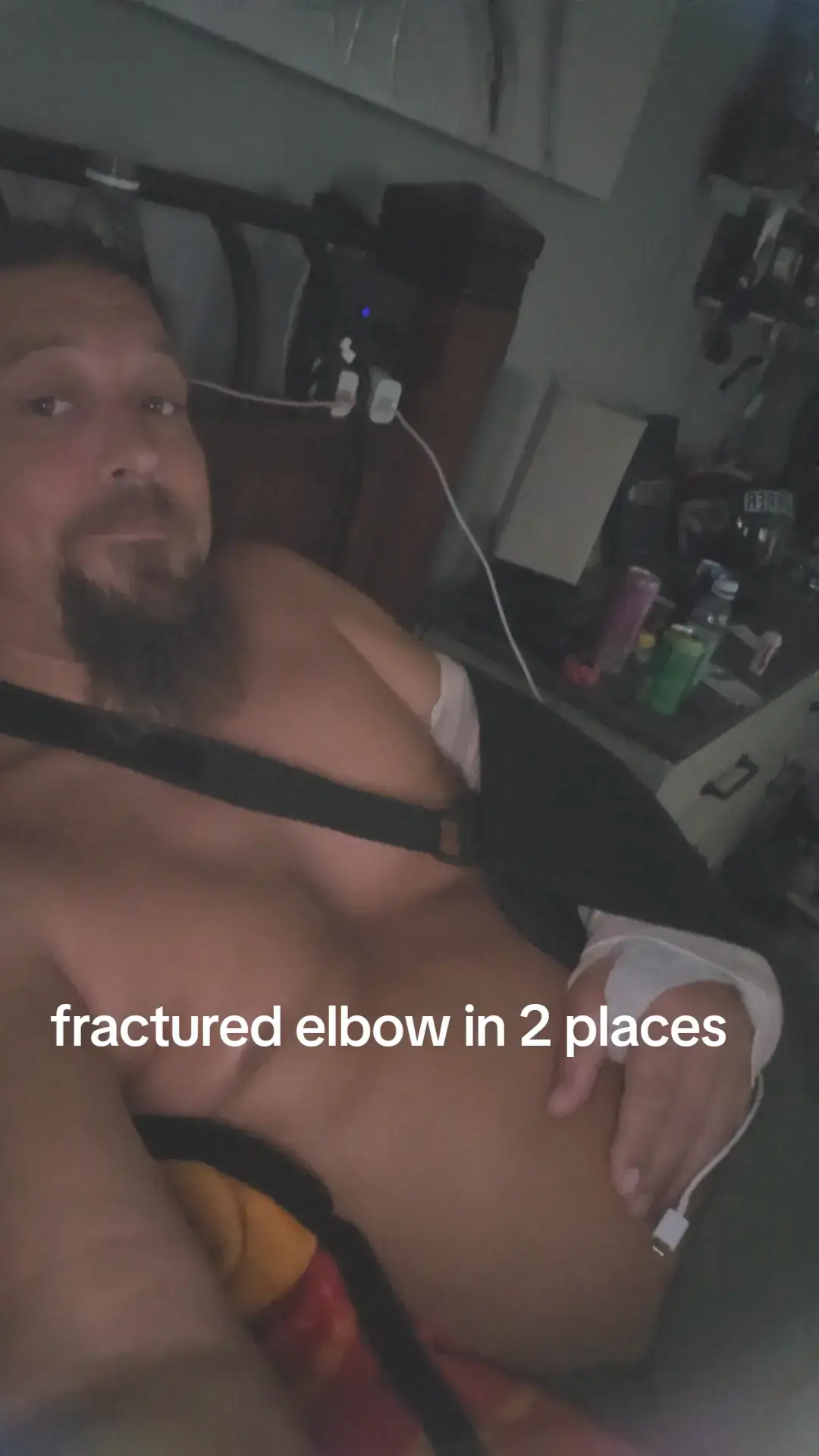 Decided to go swimming yesterday and I don't bounce like I used to. I fell from 4 feet in the air and literally bounced off my arm on concrete and fractured my elbow in 2 places #LanguageLearning #countryboy #oregon #brokenarm 