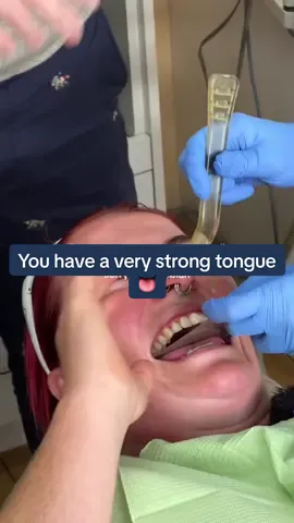 Ofc @SIENNA MALLON makes a serious moment unserious 🤣  #bitesoft #clearaligners #siennamallon #bitesoftdental #straightteeth 