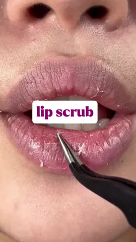 Organikaon এর মোস্ট সেলিং আইটেম গুলোর মধ্যে একটা হলো lip balm আর lip scrub। এটি ব্যবহার করে আপনার লিপ এর কালো দাগ দূর হবে, ডেড সেলস দূর হবে এবং lip পিঙ্ক এবং সফ্ট হবে।  ভালো রেজাল্ট পেতে ২ টা এক সাথেই ব্যবহার করুন। #lipfiller #lipcare #lipgloss #lipstick #pink 