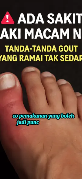 KLIK SINI @JUS GOMIX 