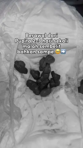 ternyata probiotik sepenting itu 😭🫶🏻 #probiotik #rekomendasiprobiotik #probiotikterbaik #sembelit #bayisembelit 