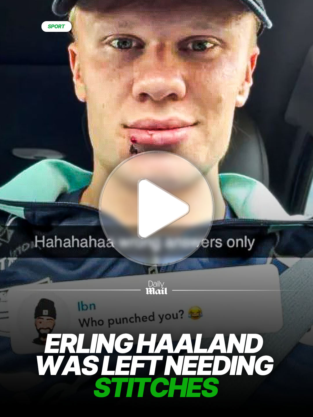 Erling Haaland has been left needing STITCHES after a freak accident 👀😲 #haaland #news #Soccer #mancity #football