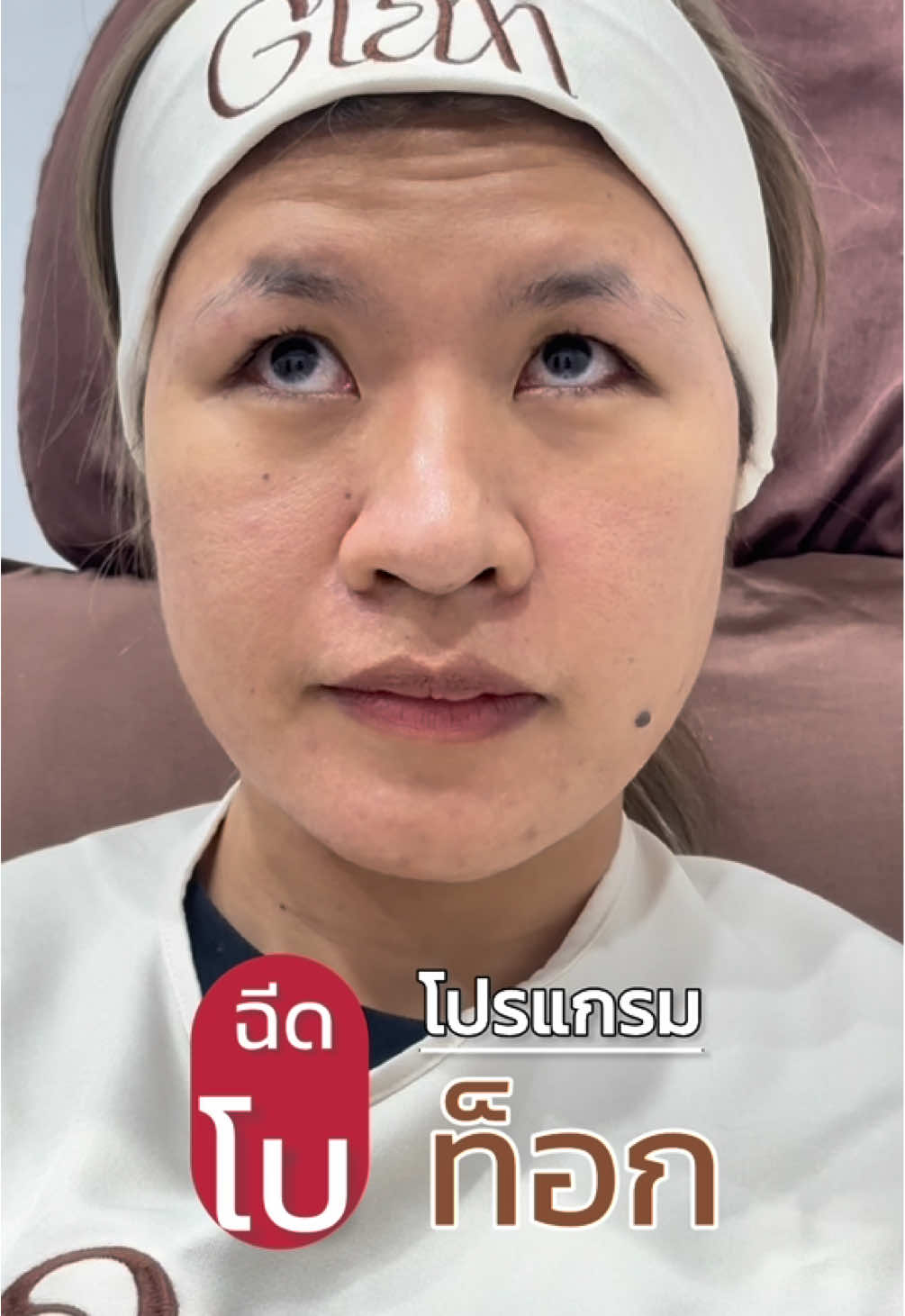 กังวลริ้วรอยมาให้เราช่วยค่ะ #เสริมความงาม #สมุทรสงคราม #glamclinic #แกรมคลินิก #โปรแกรมฉีดโบท็อกซ์ 