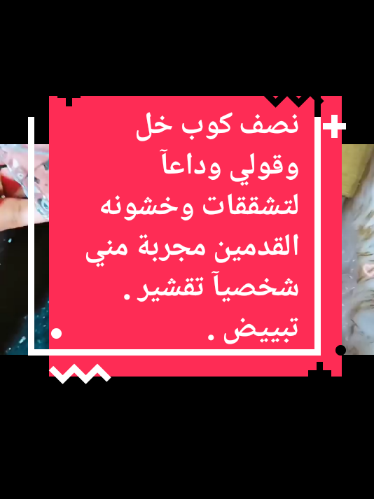 نصف كوب خل وقولي وداعآ لتشققات وخشونه القدمين مجربة مني شخصيآ تقشير . تبييض . ت#اكسبلوررررر #تفاعلكم #الشعب_الصيني_ماله_حل😂😂 #اسبانيا🇪🇸_ايطاليا🇮🇹_البرتغال🇵🇹 #لايكات 