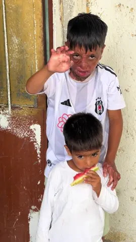 Umutcan ‘umut’ ediyor ❤️‍🩹 İyileşebilmeyi, eski sağlıklı günlerine dönmeyi ve bir de Beşiktaş’ın maçına gidebilmeyi hayal ediyor..💙 #abilerinabisiersinabi #ersinerdoğdu #iyilikkazanacak #yardım #iyilik 