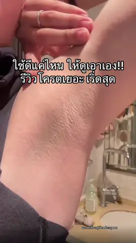 สูตรนี้เริ่ด รักแร้โครตเนียน #บอกต่อของดี #รักแร้ขาว #รักแร้เนียน #ครีมรักแร้คามู 