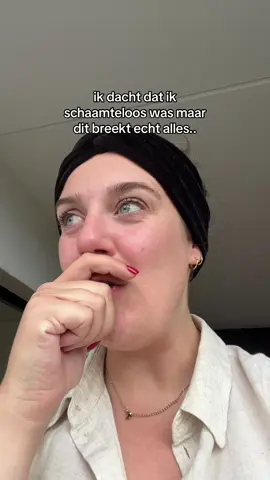 Ik vond dit echt heel heftig 😅 #chronischziek #fyp #fypageシ #alopecia #trendingvideo 