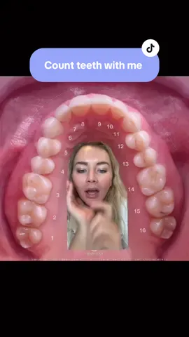Learn how to count teeth with me! Number 1 is your top right back molar 