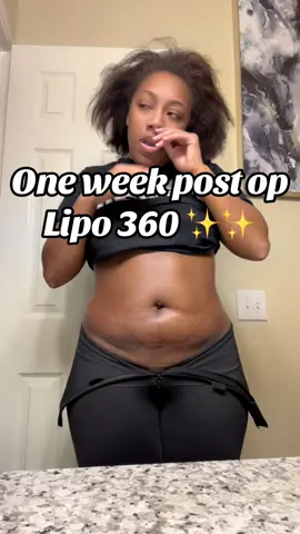 One week post op loving my results so far !! #fyp #foryou #lipo360 