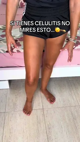 Si tienes celulitis en 2025 deberias mirar esto  #lipedema #anticellulite #celulitis #masajes #lipedemafighter 