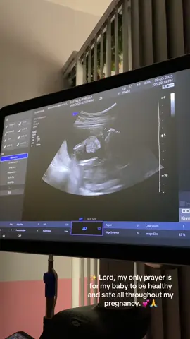 Nanay and Tatay loves you, my little one. Please grow healthy and strong in my tummy. I can’t wait to meet you 🥰❤️ #pregnancyjourney #FTM #fyp 