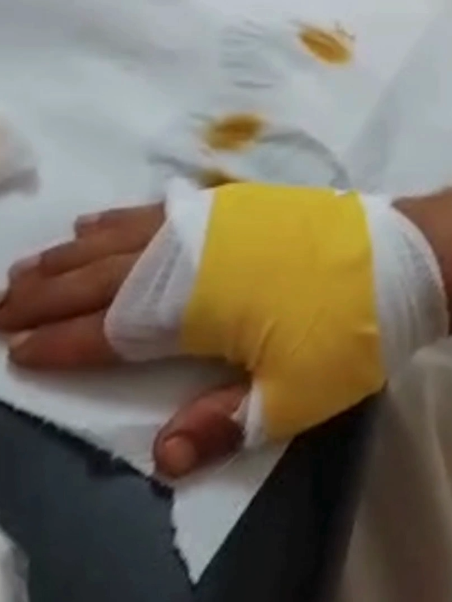 #medicazione mano # ragazzo afgano # battipaglia # nessun colore ,tutti pazienti .