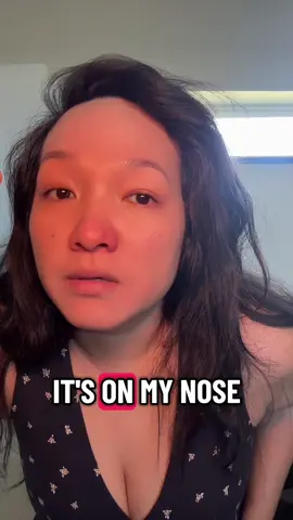 Pimples have been loving me nowadays 😒 #pimple #pimplepopper #khmer #cambodian #pimplepopping 