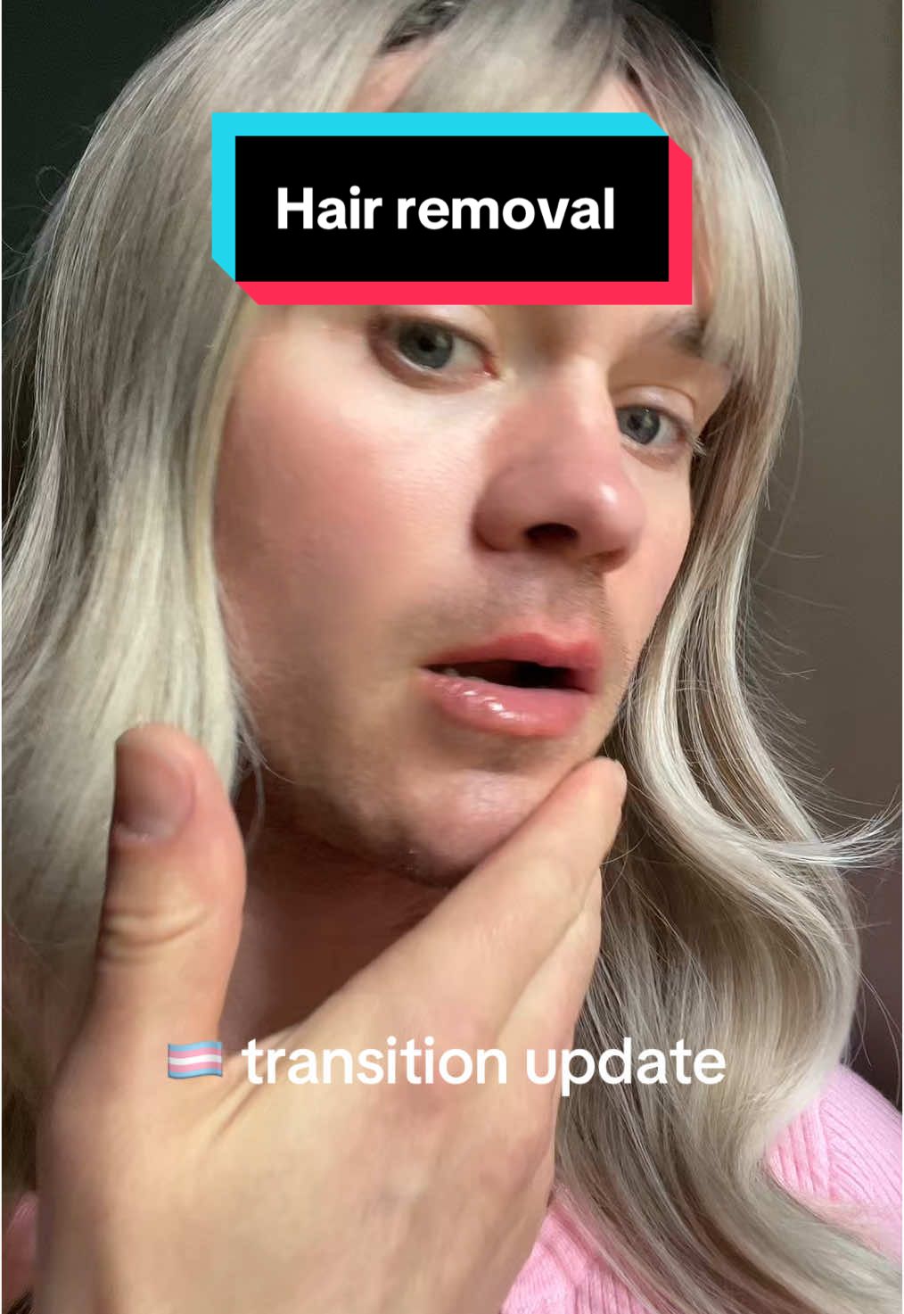 Hi, my name is Evelyn 🌸 I’m a trans woman at the very beginning of my medical transition. One of the biggest steps for me right now is getting laser hair removal and electrolysis — it’s such an important part of my gender-affirming care. Unfortunately, insurance doesn’t cover the full cost, and treatments can be thousands of dollars out of pocket. Transitioning is already really expensive, and this is just one step in a long journey. I’ve created a GoFundMe to help cover these costs. Any donation, no matter the size, or even just sharing my link, would mean the world to me. Thank you so much for supporting me as I take these steps toward living as my authentic self. 💖” #trans #transgender #transwoman 
