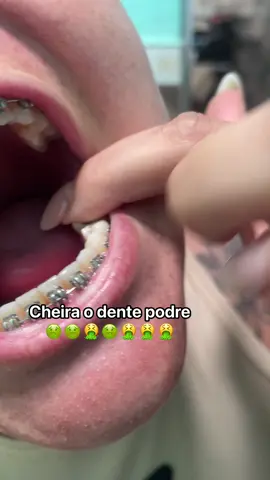 #dentista #explore #tiktokindia #dentist 