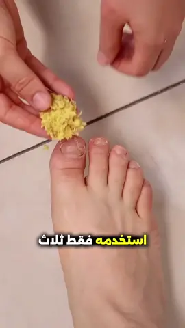 #خالتي_نورا #صحتي 