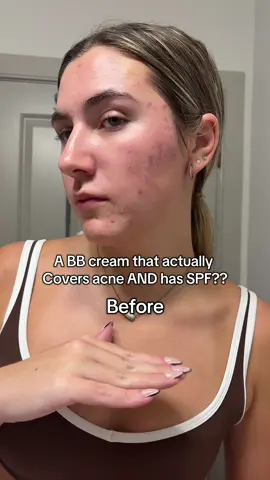 Most bb creams I’ve tried don’t cover acne, scars, dark circles, so my excitement is real with these results!! #makeup #bbcream #spf #acnescars 