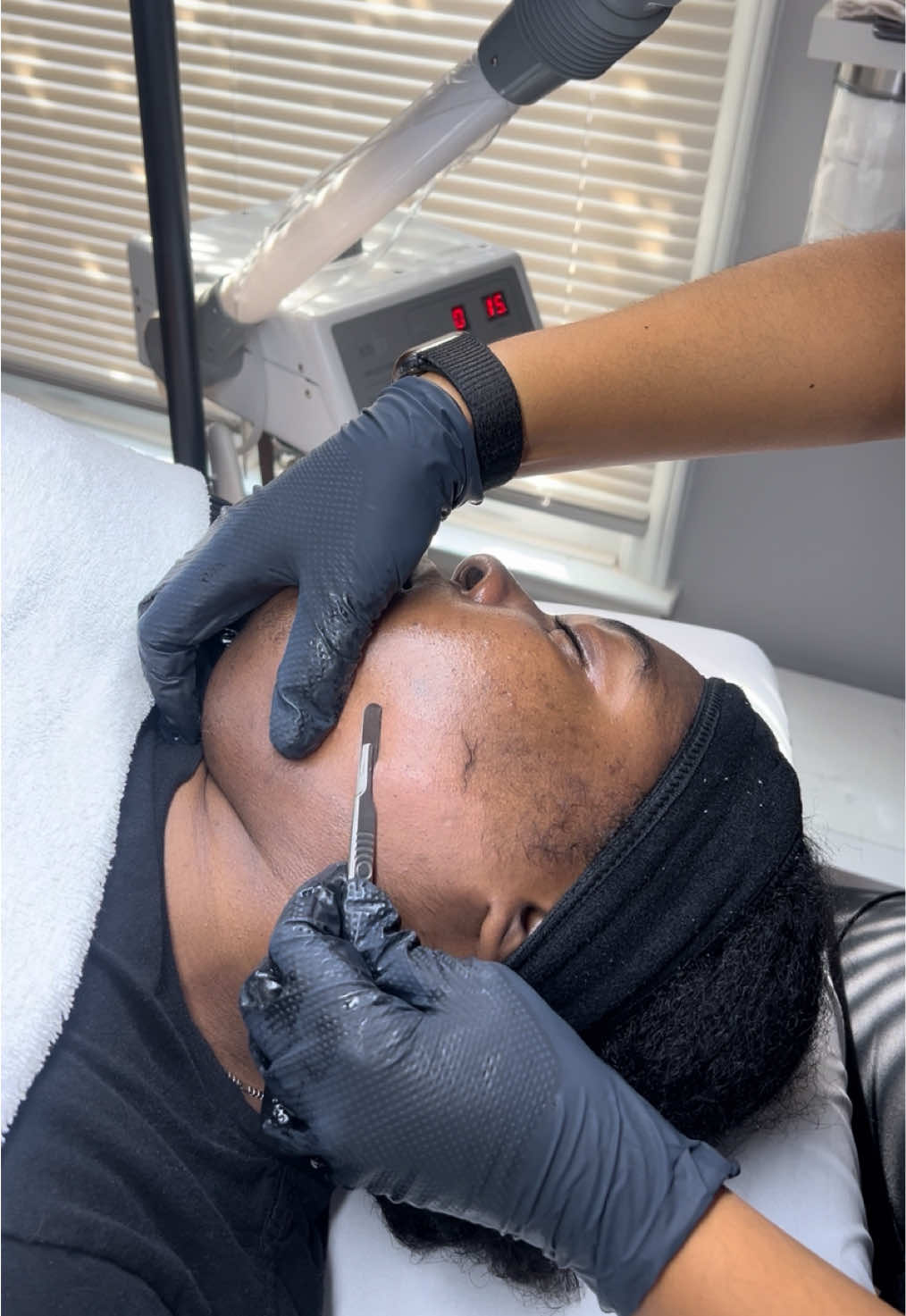 Dermaplaning has the girls in a chokehold and I don’t blame them 🤍 Baby hairs gone, skin smooth, glow unlocked. And if you love results like this, just wait until Pins & Needles: The Microneedling Mixer on October 11th ✨ An afternoon of beauty, education, luxe goodies + skin tips you’ll thank me for later. Tickets are live and I can’t wait to host you. So, find your fit & join me for the a good time! 🎀🍒⭐️ #Esthetician #CLT #Microneedling #Dermaplaning #PRP 