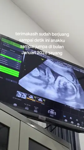 masyaAllah, baby yang tidak disangka2 ada diperut bunda dan bertahan sampai detik ini. sehat2 anak bunda. terimakasih sudah bertahan dan berjuang sampai sejauh ini #masyaallahtabarakkallah #usg #usg2d #bumil #pregnant 