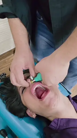 CFR for Facial Pain treatment 