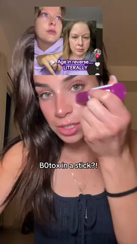 I’m so glad she didn’t gatekeep this! #filler #skincare #antiage #wrinkles #koreanskincare @Dr.Melaxin Global bye bye hollowed under eyes 🤚 