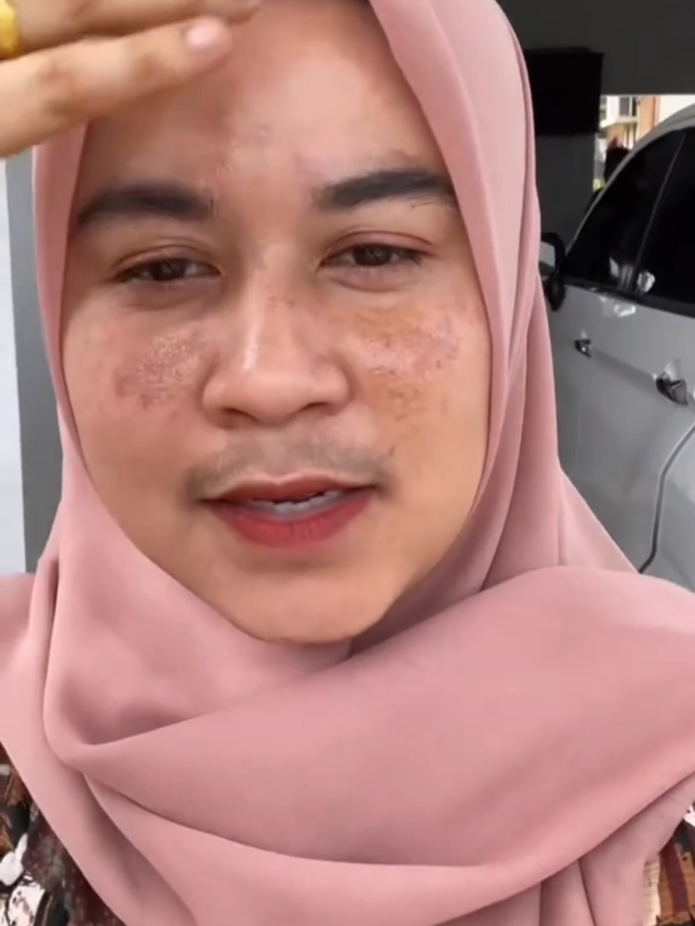 #stitch dengan @NOVA Bu, flek melasmanya bisa kita bantu dengan bahan alam 🥰 #flek #flekhitam #skincarenatural #skincarealami 
