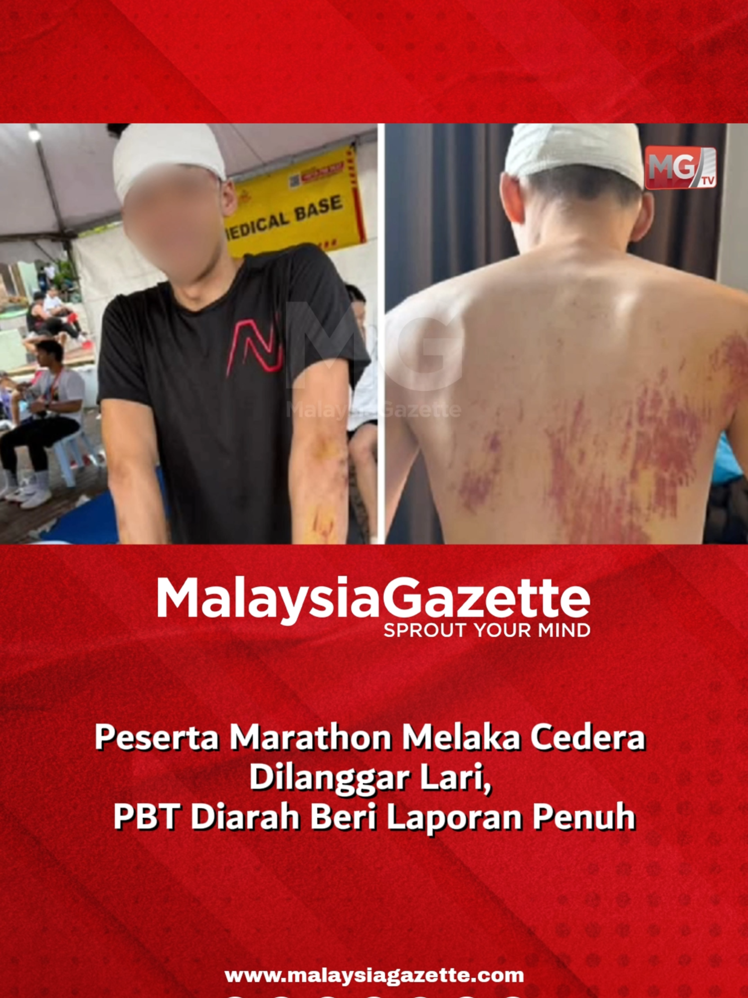 Peserta Marathon Melaka Cedera Dilanggar Lari, PBT Diarah Beri Laporan Penuh Kerajaan negeri mengarahkan dua pihak berkuasa tempatan (PBT) menyediakan laporan lengkap berhubung kes langgar lari sehingga mengakibatkan kecederaan peserta Melaka International Marathon 2025 di Dataran Sejarah, Ayer Keroh, di sini Ahad lalu. Exco Perumahan, Kerajaan Tempatan, Saliran, Perubahan Iklim dan Pengurusan Bencana negeri, Datuk Rais Yasin berkata, setakat ini, beliau ada mendengar kejadian terbabit namun belum mendapat maklumat sebenar kejadian itu. #malaysiagazette #pesertamarathondilanggarlari
