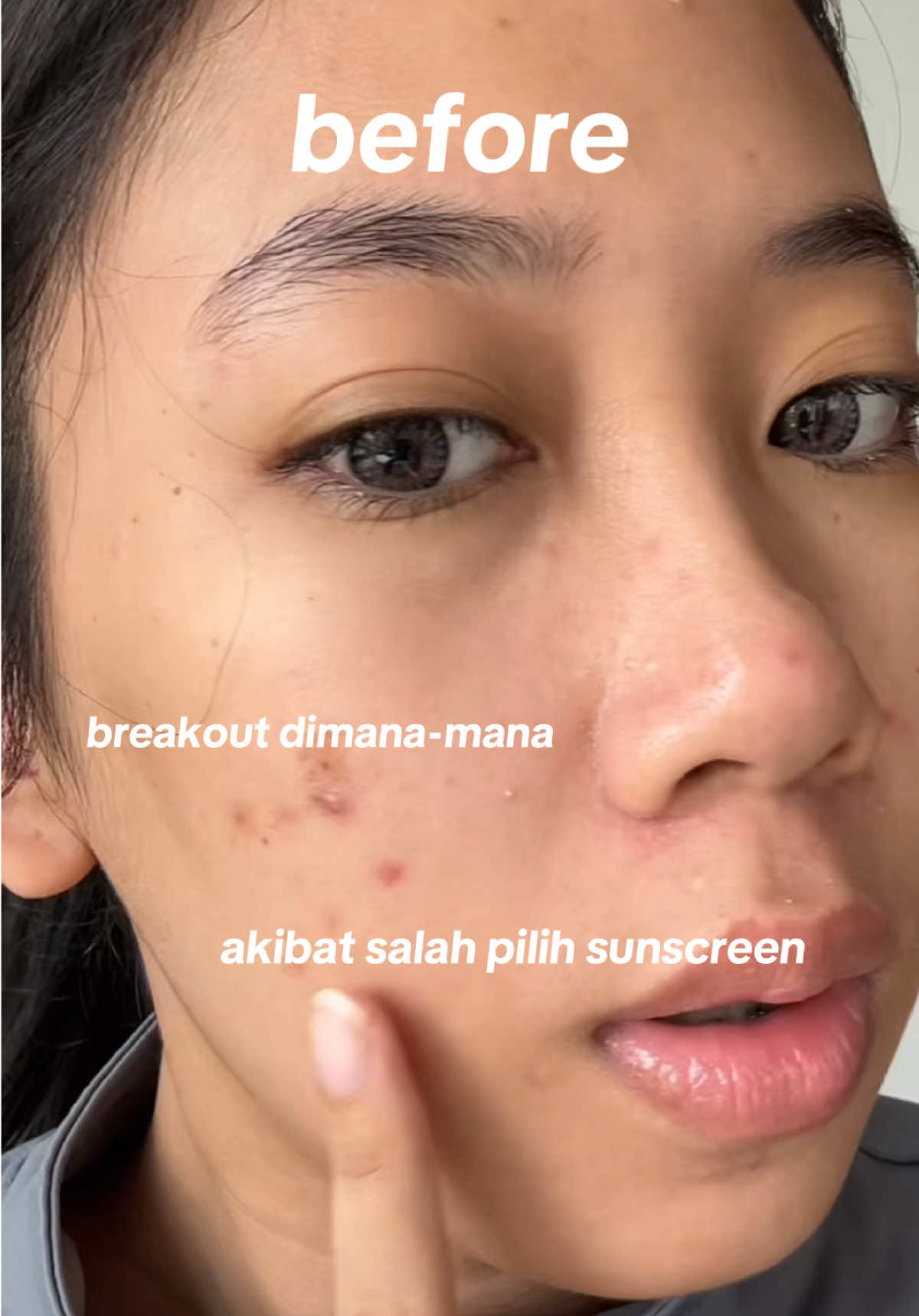 Sebagai acne fighter dengan kulit sensitif, aku harus ekstra hati-hati pilih sunscreen. Nah, ketemu yang nyaman dipakai tanpa bikin kulit rewel. 🤍 #sunscreen #facerinna 
