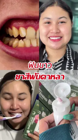 ฟันขาวหินปูนหลุด#ยาสีฟันดาหลา #ฟันขาวสะอาด #เป็นกระแสในtiktok #ยาสีฟันสมุนไพร 