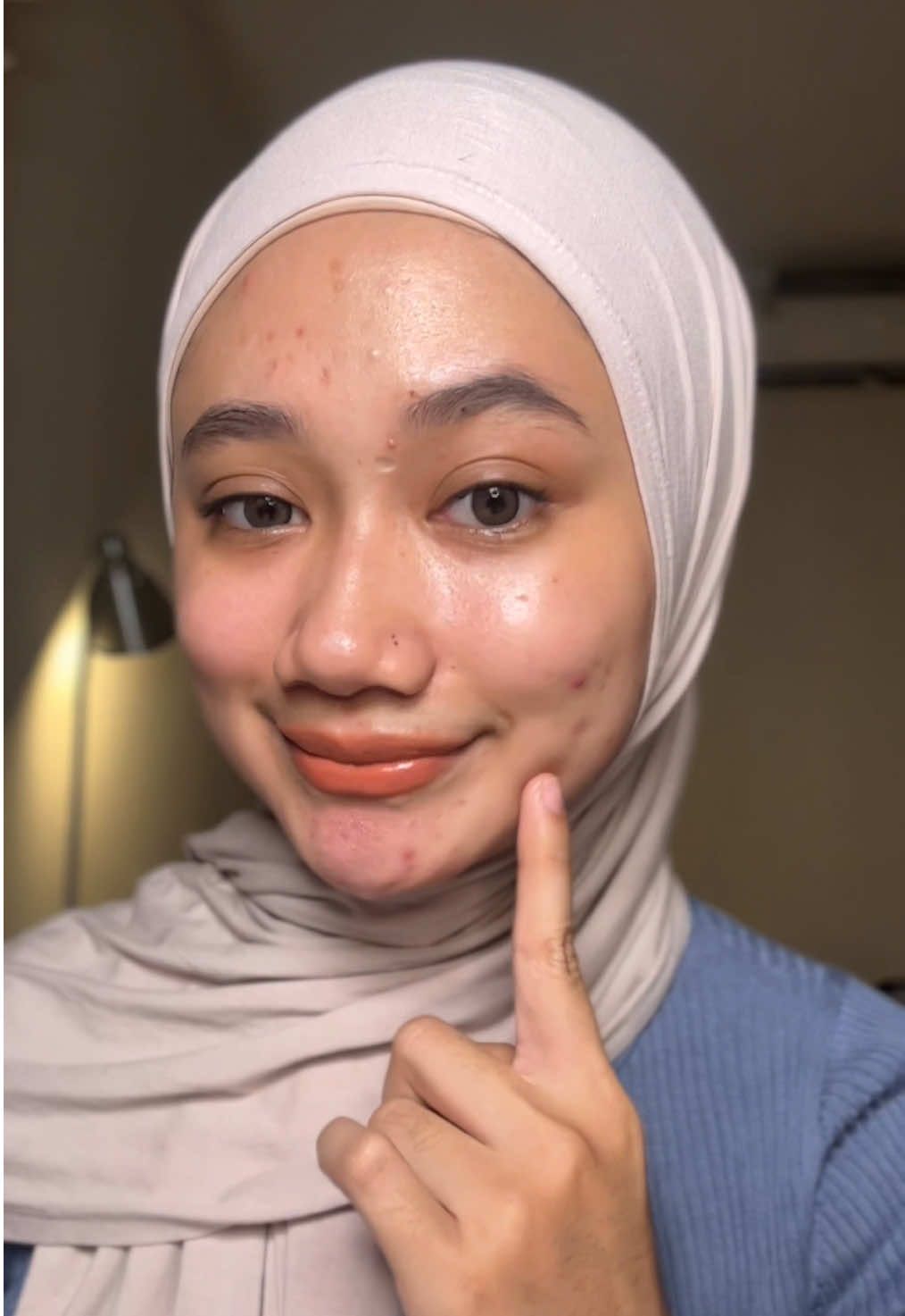 Pleaseee jangan kemakan buzzer! gamau kan jadi break out gini? dan kuncinya tuh cuma di skin barrier @LABORE #laboreskinexpert #Microbiomeinteligence #Microbiome #LABOREBarrierReviveCream #MoisturizerBuatanDokter 