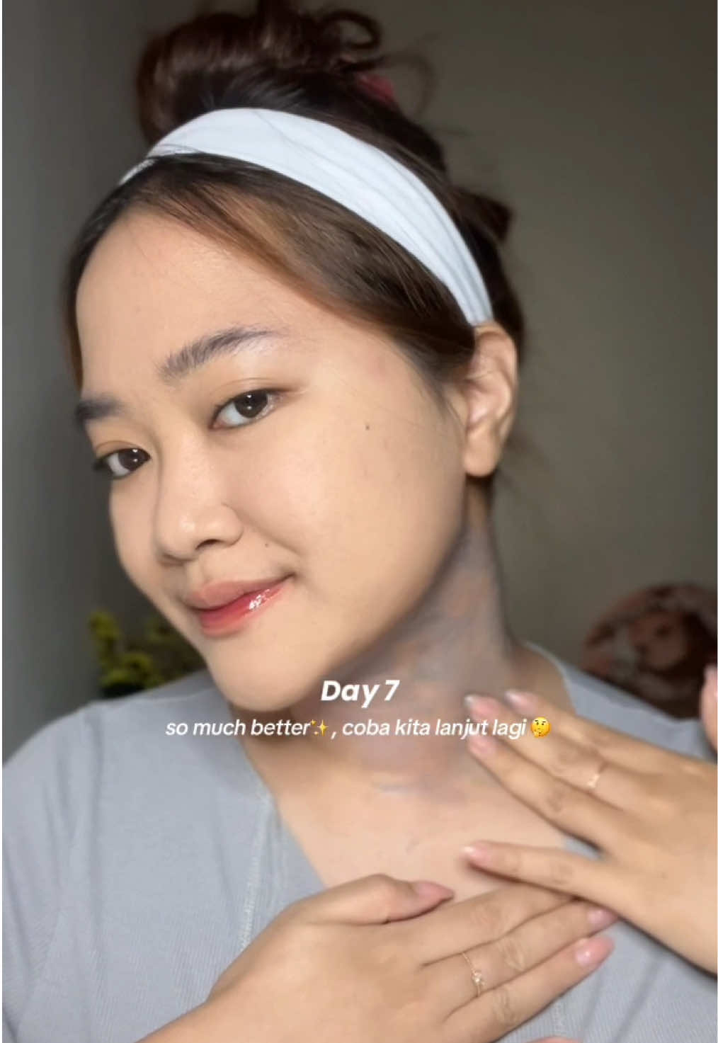 jangan di umpetin ya, coba ini biar leher jd glowing 🩵🤩#charcoalmask #maskerketiak #ketiak #pencerahketiak #brighty 