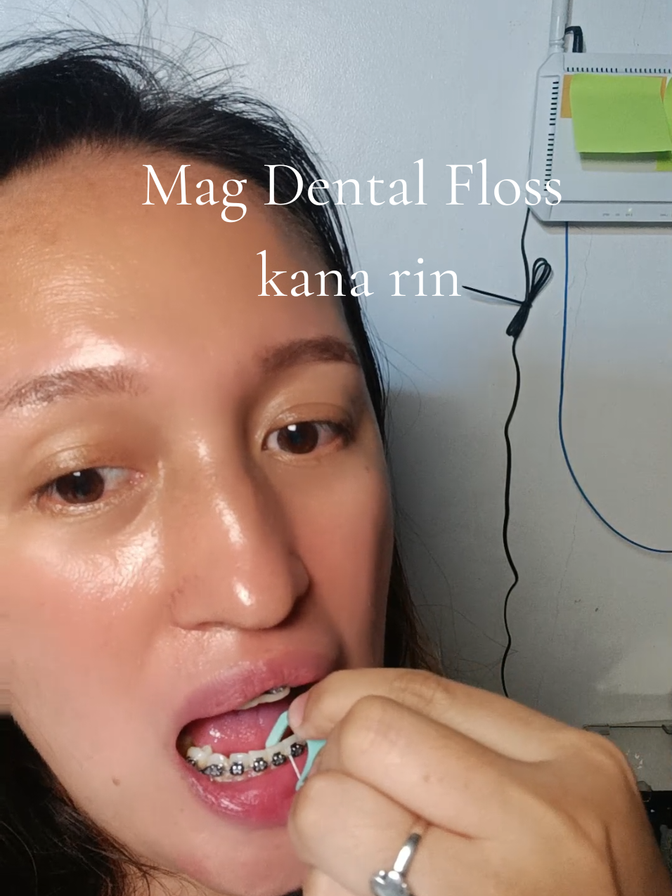 MAG DENTAL FLOSS KANA RIN  #flosssticks #dentalfloss #floss #meyarn 