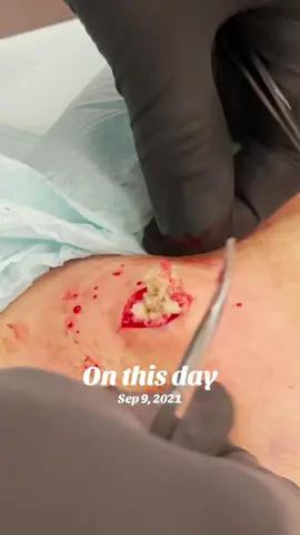 #onthisday 