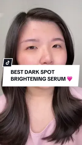Emang gada yang ngalahin melasyl serum sih buat dark spotku bestt soalnya target langsung ke sumbernya jadi lebi ngaruh 😭🩷 + bikin cerahan jugaa!! <3  @L'Oreal Paris Indonesia  #LorealParisID #GameOverNodaHitam #Melasyl #skin #Niacinamide #GlycolicAcid #BekasJerawat #Brightening #Serum 