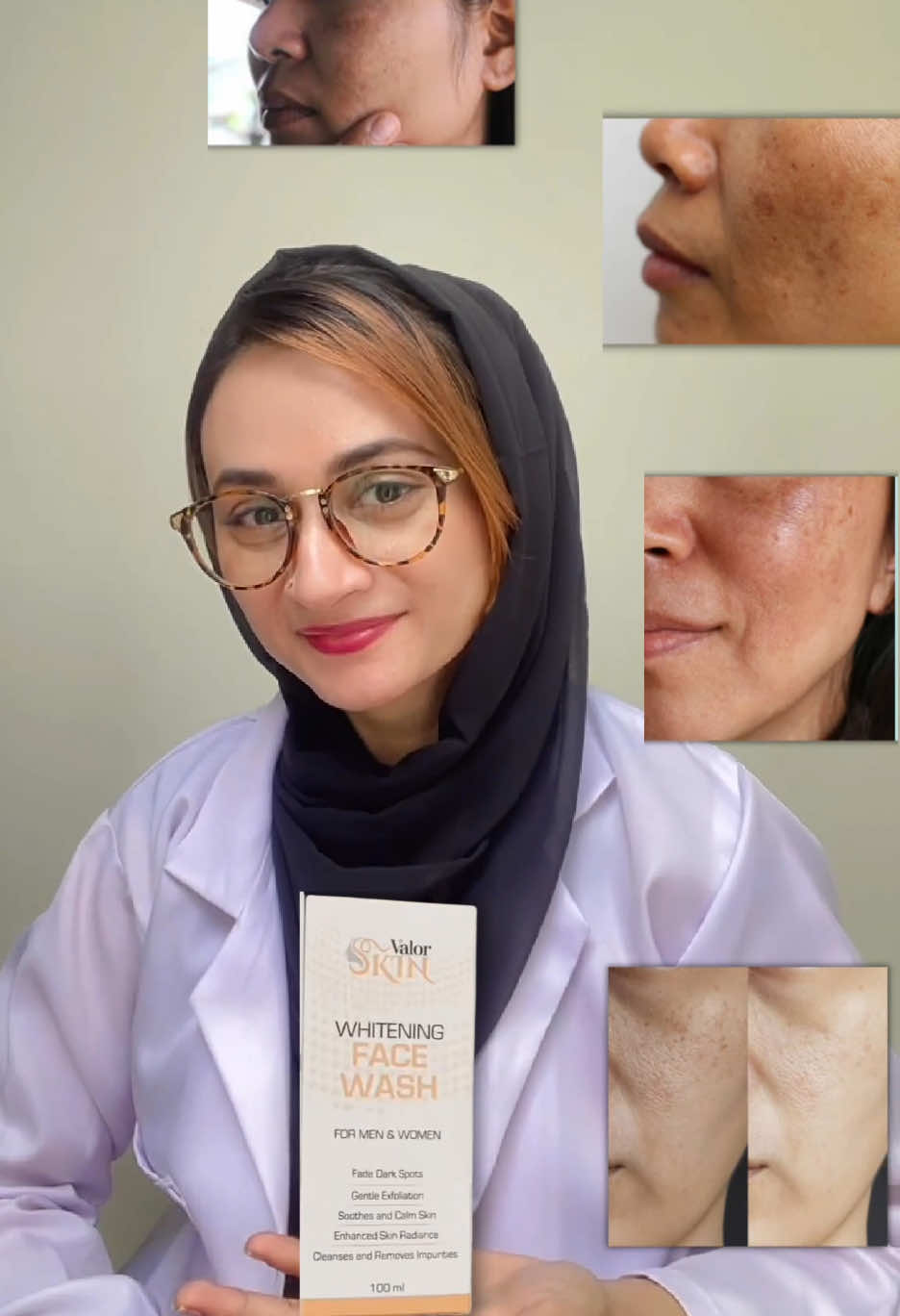 03O19747684 |  #creatorsearchinsights #skincare #skinwhitening #girls #skincareroutine 